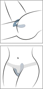 Panty-Vibrator Svakom „Erica“: blauer Einsatz am Slip, Detailansicht